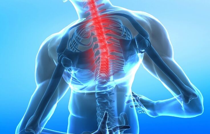 оштетување на цервикалниот 'рбет со остеохондроза