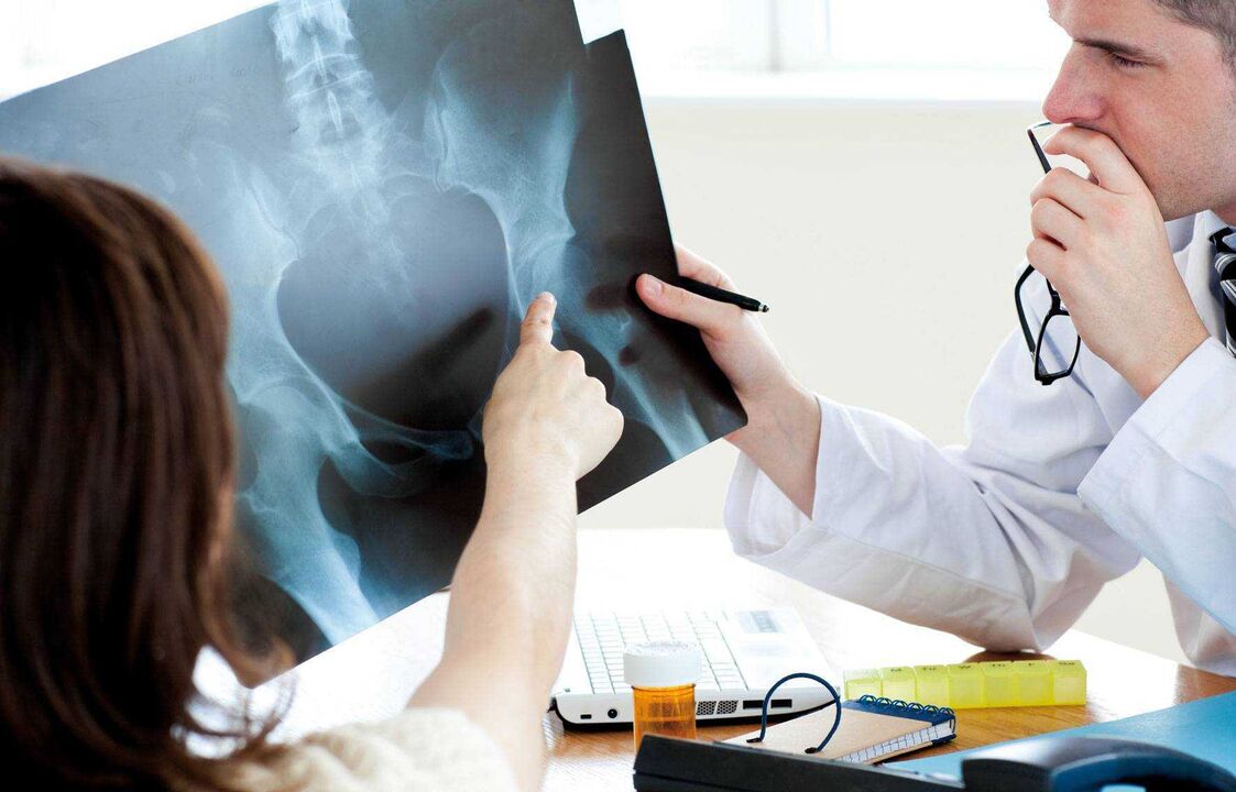 лекарите испитуваат рендген за артроза на колкот
