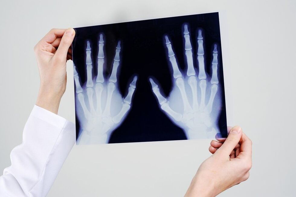 дијагностика на рачни зглобови